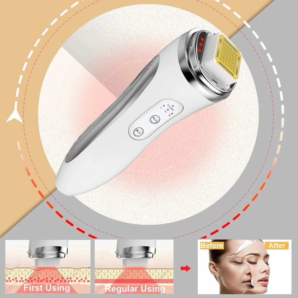Facial Rejuvenation Massager