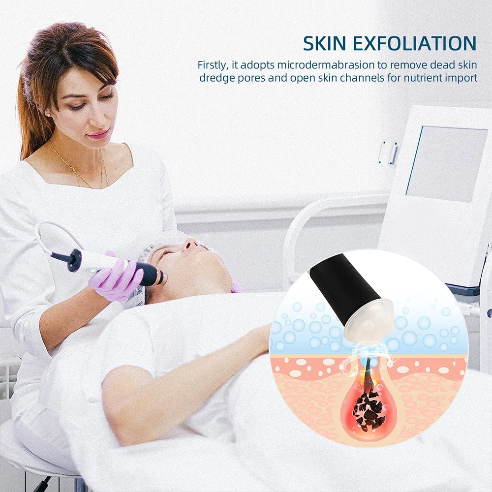 Facial CO2 Oxygen Bubble Gel – Brighten & Lift