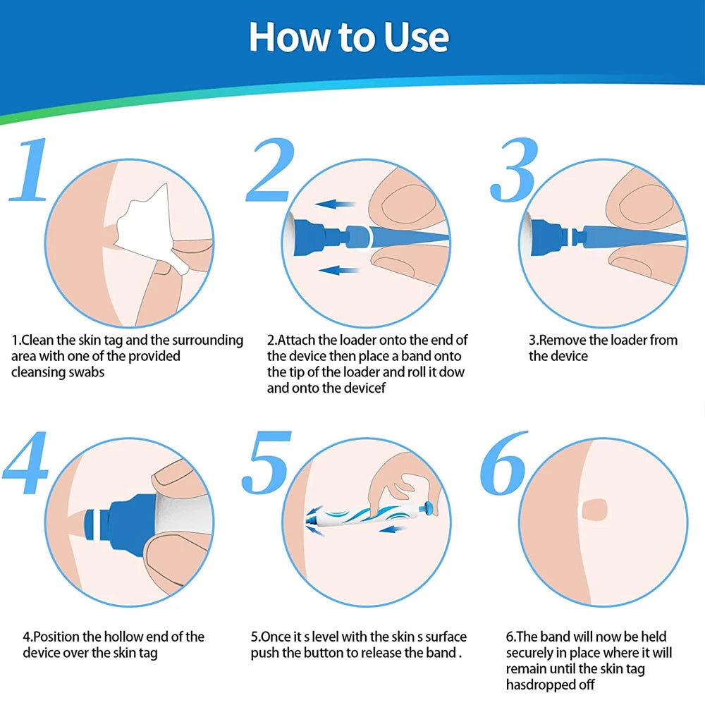 2-in-1 Automatic Skin Tag & Mole Remover