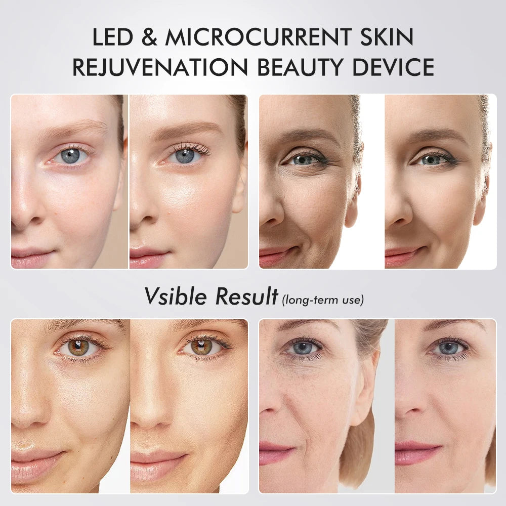 Age Boosters Pro R6 EMS RF LED Facial Device Skin Tightening Anti Wrinkle Pore Cleaner Beauty Tool