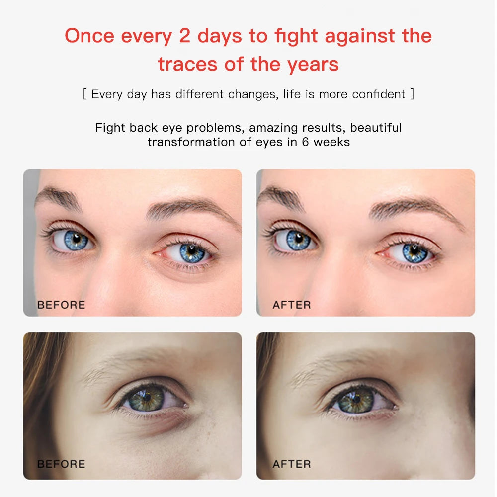 Eye Face Vibration Massager Electric