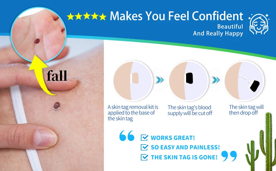 2-in-1 Automatic Skin Tag & Mole Remover