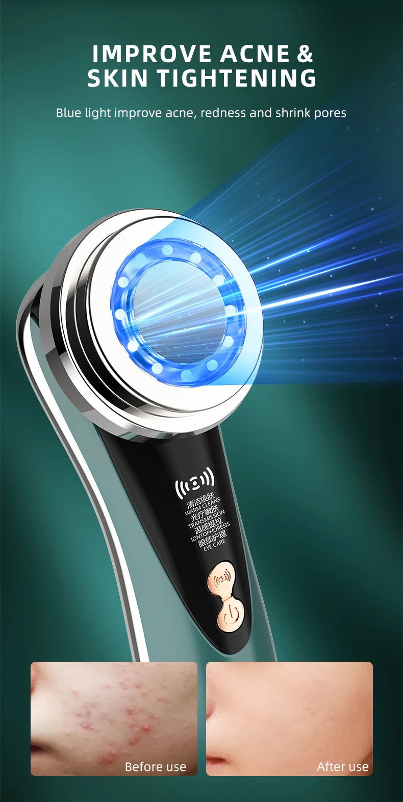 EMS Facial Massager