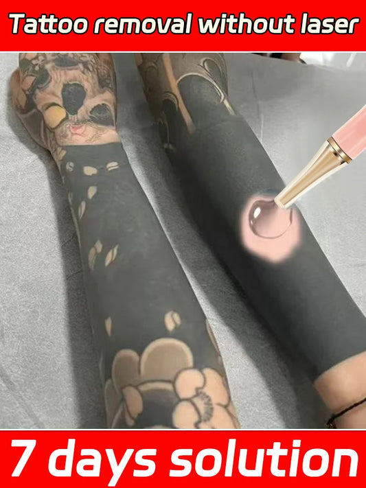 Tattoo Removal Cream for Permanent Makeup and Body Ink – Fast 7 Day Solution
